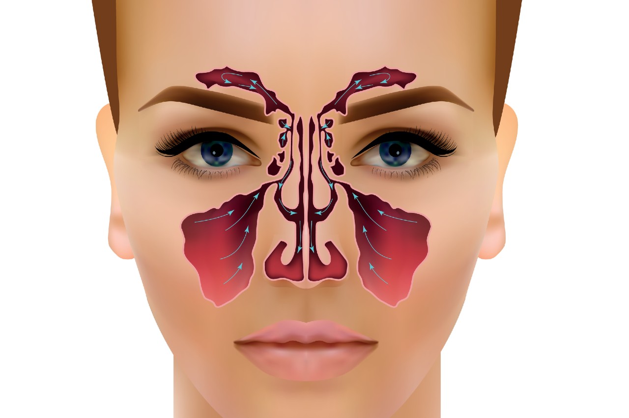 Diagram of the facial sinuses treated with Manual Lymph Drainage